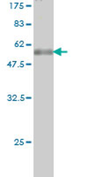 TPMT monoclonal antibody (M03), clone 2H3