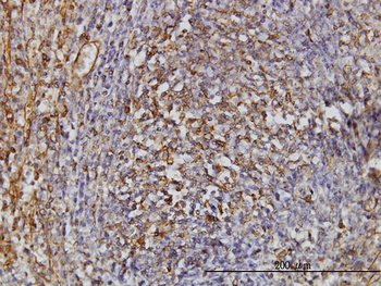 TPMT monoclonal antibody (M01), clone 1B5