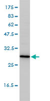 TPMT monoclonal antibody (M01), clone 1B5