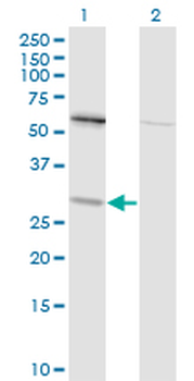 TPMT monoclonal antibody (M01), clone 1B5