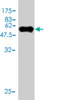 TPMT monoclonal antibody (M01), clone 1B5