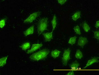 TPM4 monoclonal antibody (M01), clone 4E4-1D2