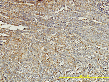 TPM4 monoclonal antibody (M01), clone 4E4-1D2