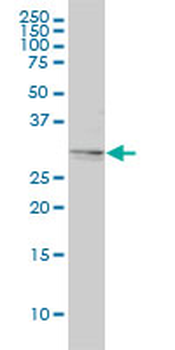 TPM4 monoclonal antibody (M01), clone 4E4-1D2