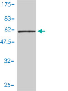 TPM4 monoclonal antibody (M01), clone 4E4-1D2