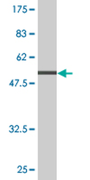 TPM3 monoclonal antibody (M02), clone 2E4
