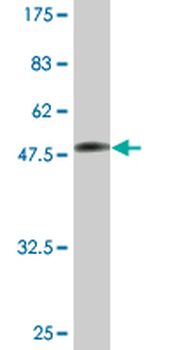 TPI1 monoclonal antibody (M02A), clone 2C3