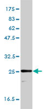 TPI1 monoclonal antibody (M01), clone 1D10-2E2