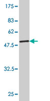 TPI1 monoclonal antibody (M01), clone 1D10-2E2
