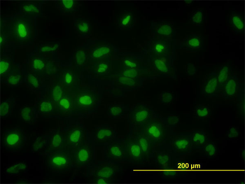 TOP2A monoclonal antibody (M01), clone 1E2