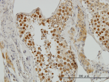 TOP2A monoclonal antibody (M01), clone 1E2