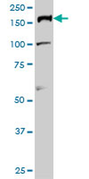 TOP2A monoclonal antibody (M01), clone 1E2