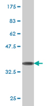 TOP2A monoclonal antibody (M01), clone 1E2