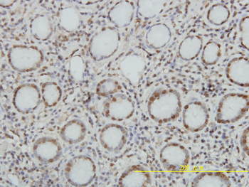 TOP1 monoclonal antibody (M01), clone 1A1