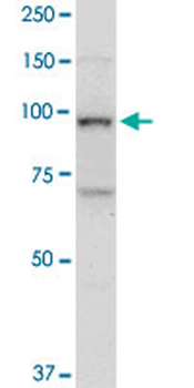 TOP1 monoclonal antibody (M01), clone 1A1