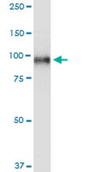 TOP1 monoclonal antibody (M01), clone 1A1