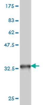TOP1 monoclonal antibody (M01), clone 1A1