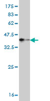 TNNT3 monoclonal antibody (M02), clone 1F12