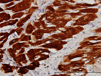 TNNC1 monoclonal antibody (M01), clone 1F8-A9