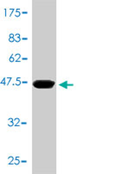 TNNC1 monoclonal antibody (M01), clone 1F8-A9