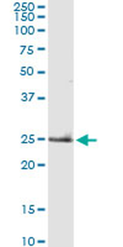 TNF monoclonal antibody (M03), clone M1-C4