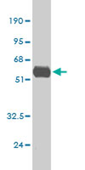 TNF monoclonal antibody (M03), clone M1-C4