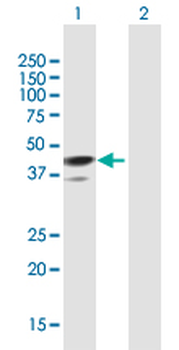 TMOD1 purified MaxPab mouse polyclonal antibody (B01P)