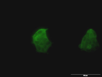 TSPAN8 monoclonal antibody (M02), clone 1E5