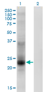 TSPAN8 monoclonal antibody (M02), clone 1E5