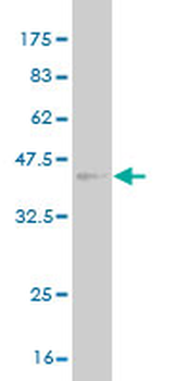 TSPAN8 monoclonal antibody (M02), clone 1E5