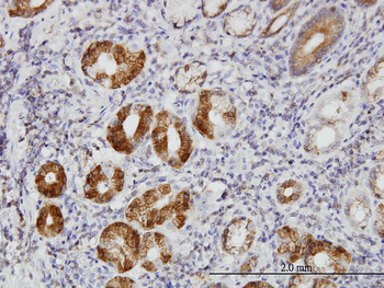 TLN1 monoclonal antibody (M05), clone 5C1