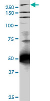 TLN1 monoclonal antibody (M05), clone 5C1