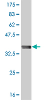 TLN1 monoclonal antibody (M05), clone 5C1