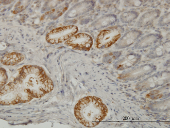 TLN1 monoclonal antibody (M03), clone 1A11