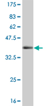 TLN1 monoclonal antibody (M03), clone 1A11