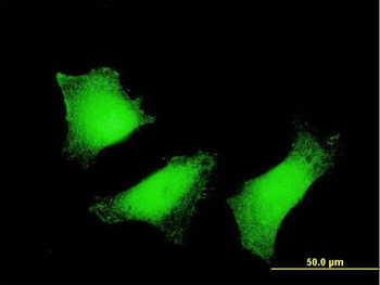 TGM2 monoclonal antibody (M10), clone 2F4