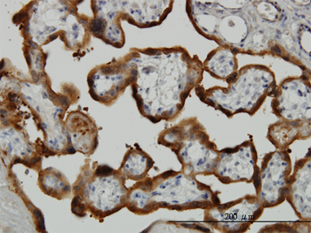 TGM2 monoclonal antibody (M10), clone 2F4