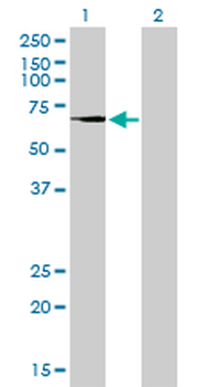 TGM2 monoclonal antibody (M10), clone 2F4