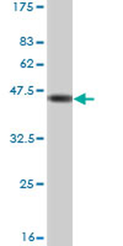 TGM2 monoclonal antibody (M10), clone 2F4