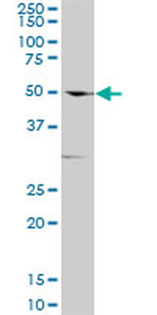 TGFBR1 polyclonal antibody (A01)
