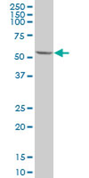 TGFBR1 polyclonal antibody (A01)