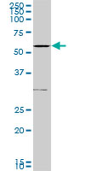 TGFBR1 polyclonal antibody (A01)