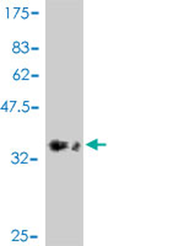 TGFBR1 polyclonal antibody (A01)