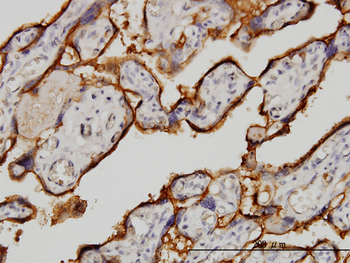 TFRC monoclonal antibody (M01), clone 1E6