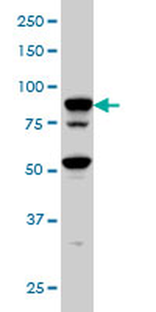 TFRC monoclonal antibody (M01), clone 1E6