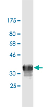 TFRC monoclonal antibody (M01), clone 1E6