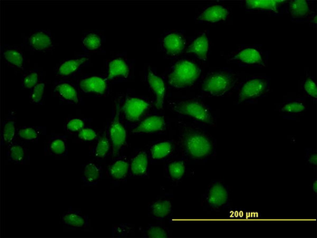 TFAP4 monoclonal antibody (M01), clone 6B1