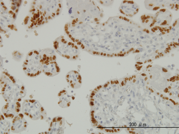 TFAP2A monoclonal antibody (M01), clone 2G5