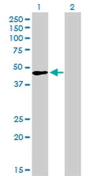 TFAP2A monoclonal antibody (M01), clone 2G5