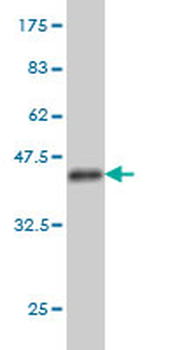 TFAP2A monoclonal antibody (M01), clone 2G5